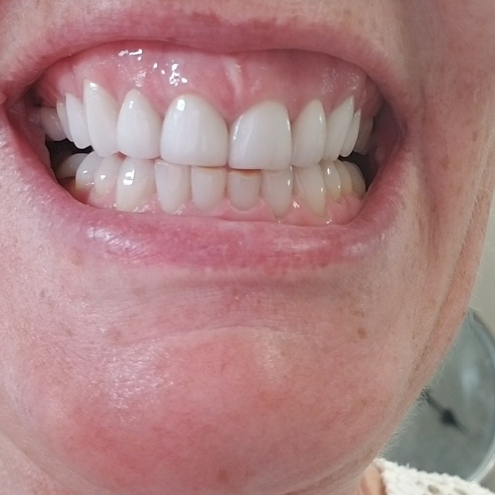 AP24 toothpaste - Picture 2 of 3